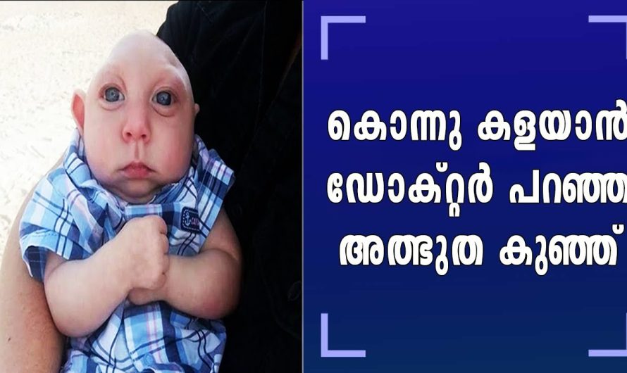 14 ആഴ്ച മാത്രമുള്ളപ്പോൾ ഡ്രോക്ടർമാർ കൊന്നു കളയാൻ പറഞ്ഞ കുഞ്ഞ്, ജീവിതത്തിലേക്ക് തിരിച്ചു വരുന്നത് കണ്ടോ ഇതാണ് അമ്മയുടെ സ്നേഹം