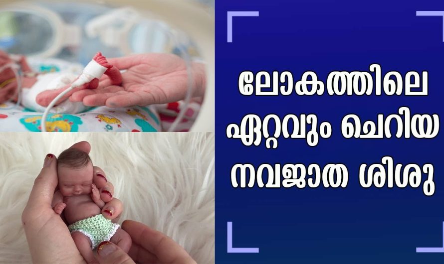 അഞ്ചാം മാസത്തിൽ തന്നെ പ്രസവിച്ച കുഞ്ഞിന്റെ കഥ കേട്ടോ, ഇതാണ് ലോകത്തിലെ ഏറ്റവും ചെറിയ കുഞ്ഞ്