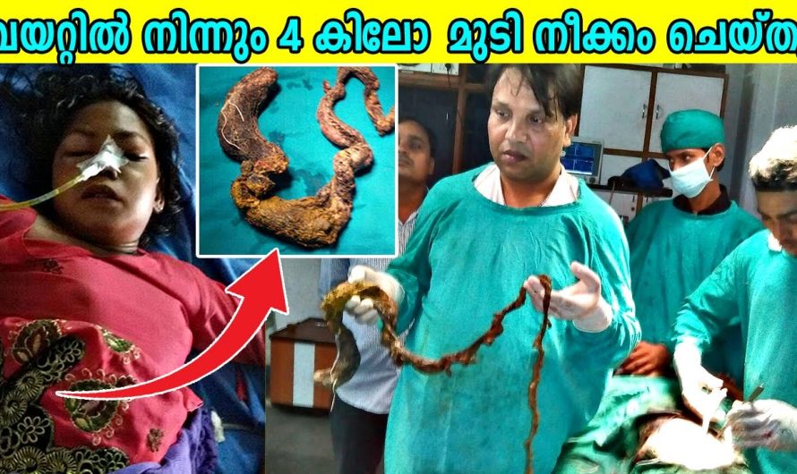 മനുഷ്യ ശരീരത്തിൽ നിന്നും കണ്ടെത്തിയ അത്ഭുതകരമായ വസ്തുക്കളെ കുറിച്ച് മനസ്സിലാക്കാം…