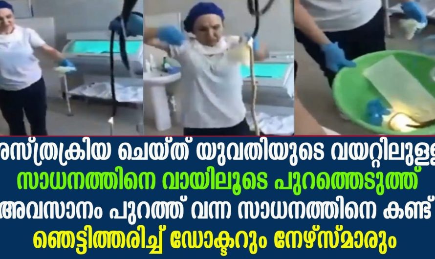 ശസ്ത്രക്രിയ ചെയ്തപ്പോൾ യുവതിയുടെ വയറിനുള്ളിൽ നിന്നും കിട്ടിയ സാധനത്തിനെ കണ്ട് ഡോക്ടർമാർ ഞെട്ടി..