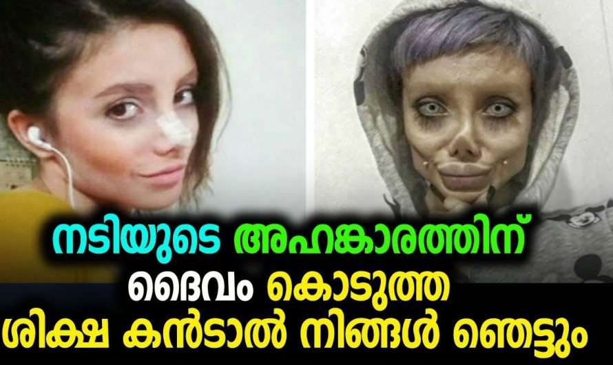 ഹോളിവുഡ് നടിയെ പോലെ ആവാൻ വേണ്ടി ശാസ്ത്രക്രിയ ചെയ്ത 19 കാരിക്ക് സംഭവിച്ചത് കണ്ടോ…