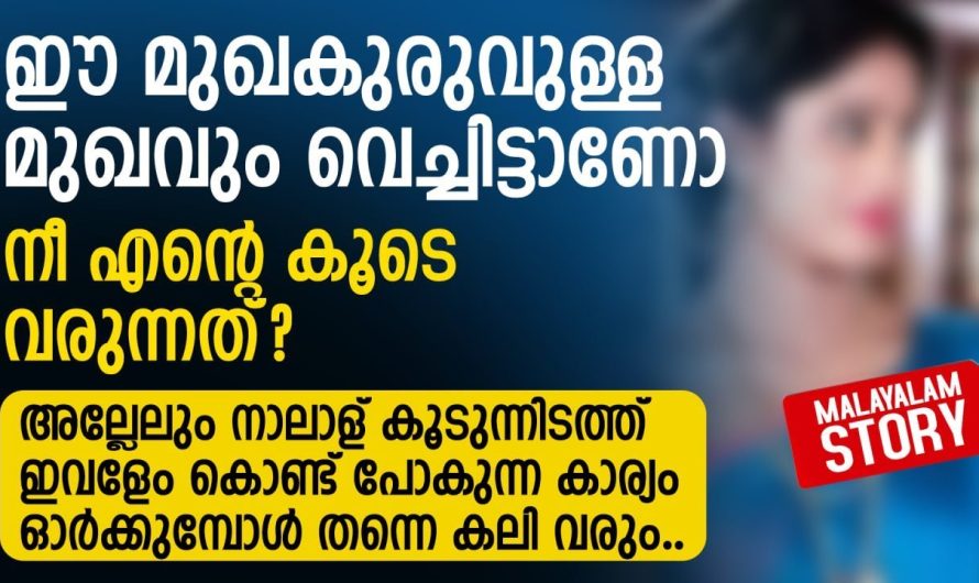 സ്വന്തം ഭാര്യയെ മുഖക്കുരുവിന്റെ പേരിൽ അധിക്ഷേപിച്ചപ്പോൾ അമ്മായിയമ്മ ചെയ്തത് കണ്ടോ…