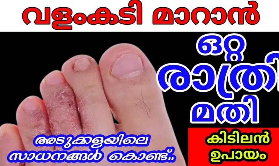 മഴക്കാലങ്ങളിൽ ഉണ്ടാകുന്ന വളം കടി പോലുള്ള പ്രശ്നങ്ങൾ ഈസിയായി പരിഹരിക്കാം..
