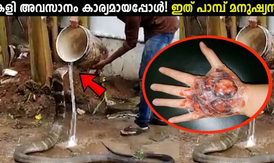 172 തവണ വിഷമുള്ള പാമ്പുകളിൽ നിന്നും കടിയേറ്റിട്ടും മരിക്കാത്ത മനുഷ്യൻ..