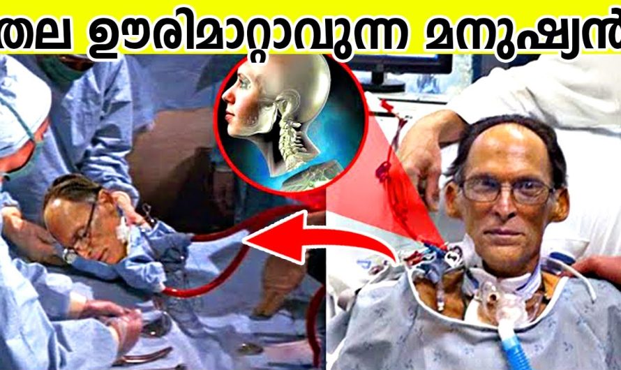 വളരെ വിചിത്രമായ രീതിയിൽ രൂപ ഘടനയിൽ ലോകത്ത് ജനിച്ച മനുഷ്യർ..