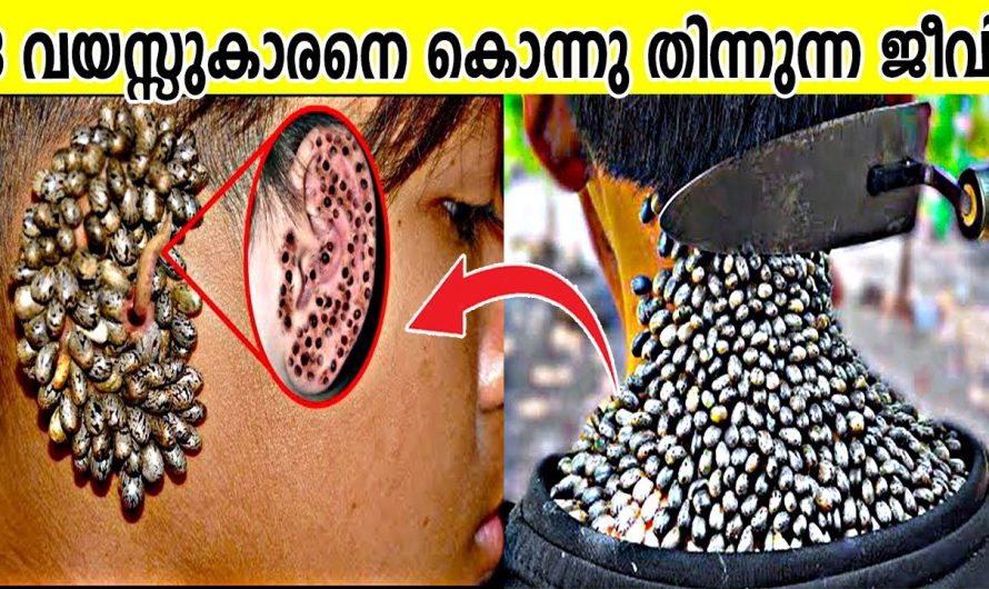 ശരീരത്തിലേക്ക് പ്രവേശിച്ചാൽ മരണംവരെ സംഭവിക്കാൻ സാധ്യതയുള്ള കുഞ്ഞൻ ജീവികൾ..