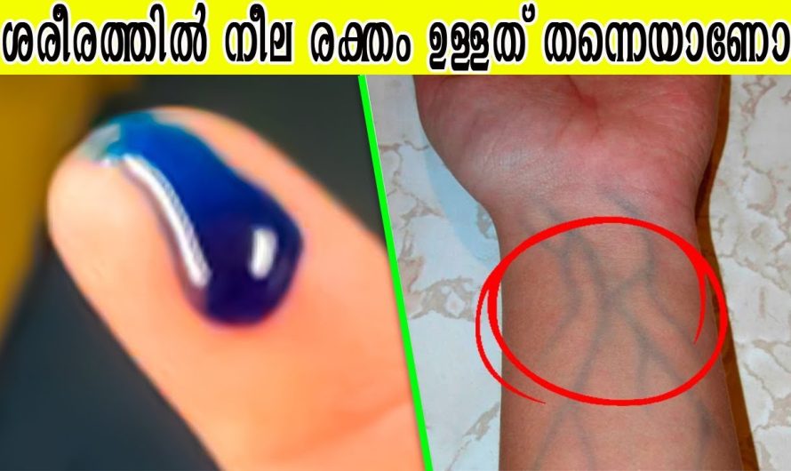 ഗൂഗിൾ ചെയ്യാൻ നിങ്ങൾക്ക് മടിയുള്ള കാര്യങ്ങൾ