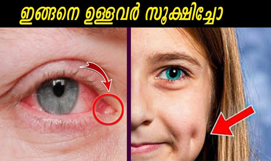 ഇത് അറിയാൻ മടിച്ചിരിക്കേണ്ട കാര്യമാണോ
