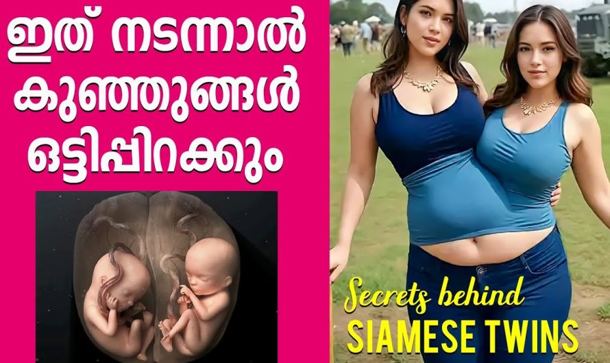 ഇരട്ടകളുടെ ജനനത്തിന് പിന്നിലെ രഹസ്യങ്ങൾ